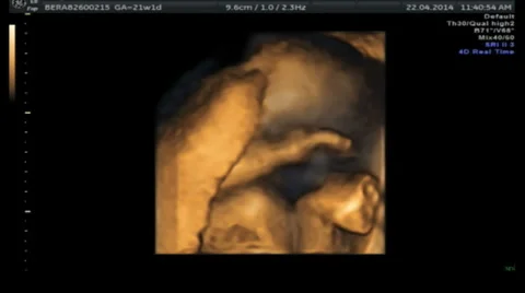 Fetus Foetus Ultasound Stock Footage 37416541