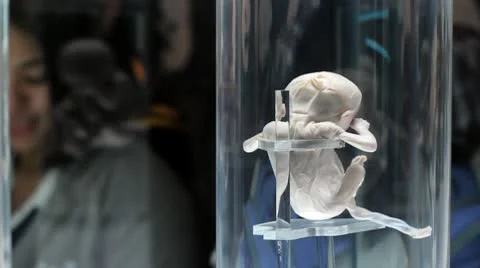 Fetus Video stock 10609712