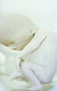 Fetus in formalin solution Stock Photos