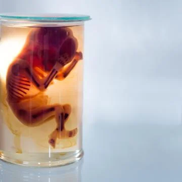 Fetus in formalin solution Stock Photos