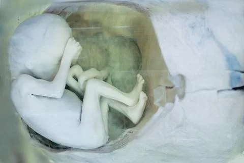 Fetus in formalin solution Stock Photos