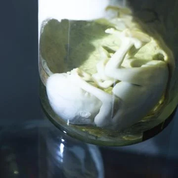 Fetus in formalin solution Stock Photos