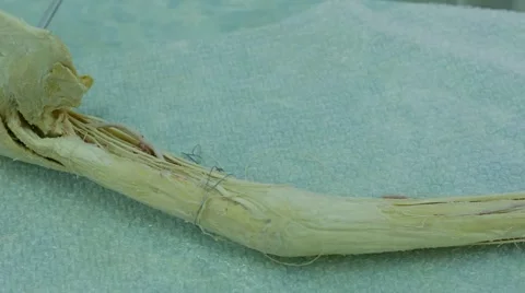 Fiber Sample of Human Limbs Stock Footage 67463416