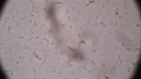 Fibers viewed under microscope Stock Footage 70723078