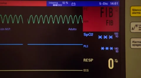 Fibrilation device Stock Footage 49779631