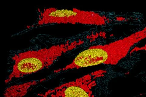 Fibroblast cells Foto stock