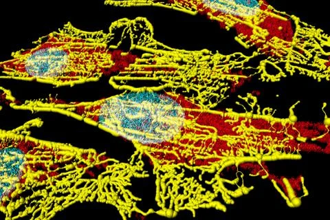 Fibroblast cells Foto stock