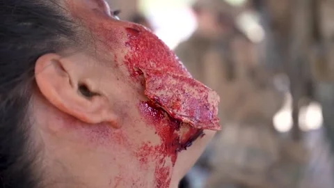 Field simulation technician applying latex and stage blood to soldiers face Video stock 280470443