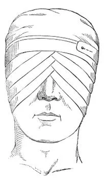 Fig. 176. Spectacles or eye bandage crosses two globes, vintage engraving. Stock Illustration