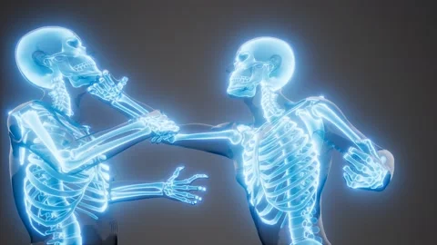 Fighting men with visible bones 库存影片 105649144