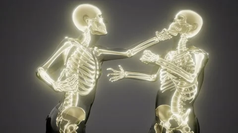 Fighting men with visible bones Stock Footage 164640623