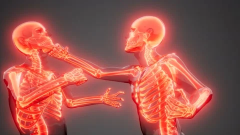 Fighting men with visible bones Stock Footage 166346937