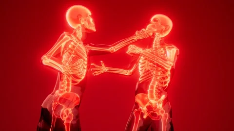 Fighting men with visible bones Stock Footage 201332588