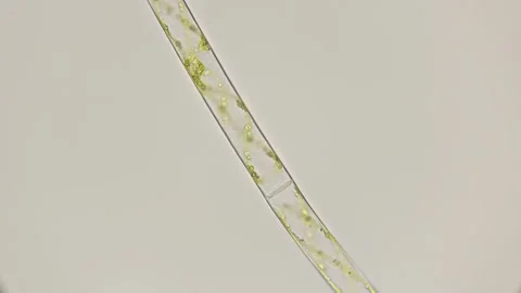 Filamentous algae Spirogrya under the microscope Stock Footage 89701110