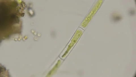 Filamentous algae under a microscope Stock Footage 89566922