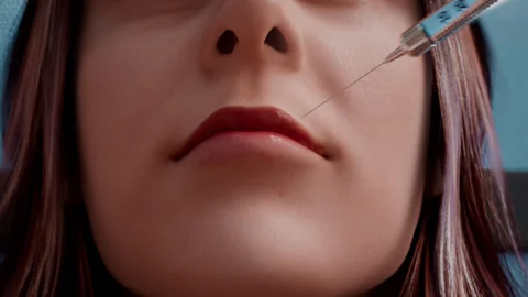 Filler injection on lips Vidéo 246612142