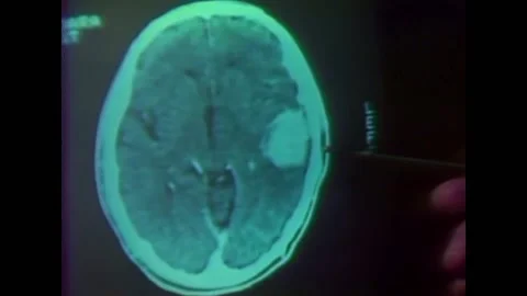 A film in Arabic explores the use of computer technology in medicine. Stock Footage 157214816