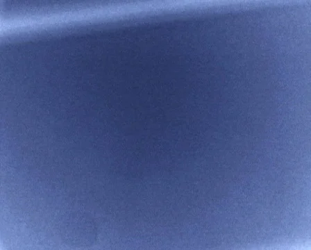 Film Frame Jumps Stock Footage 103498