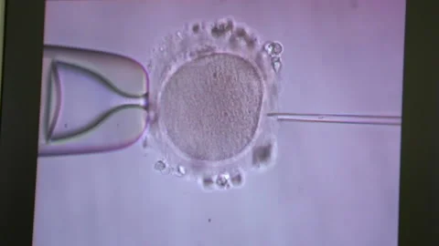 Filming of process of fertilization of female egg, sperm penetrates, genetics Stock Footage 132741035