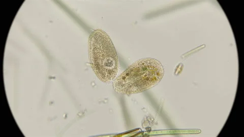 The final stage of two infusoria Oxytricha, under a microscope Stock Footage 95679021