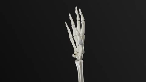 Finger ligament rupture 4K Video stock 285579133