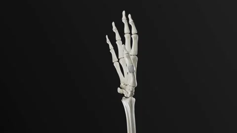 Finger ligament rupture HD Video stock 285579088