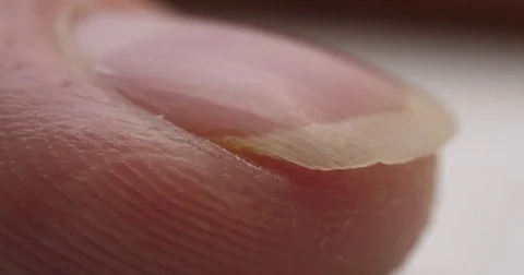 Finger Nail Being Cut Macro Close Up on White Side View Stock Footage 80968340