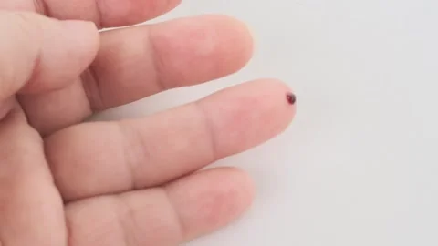 Finger prick for blood self-testing, Blood self-test procedure, showing fin.. Stock Footage 330123821