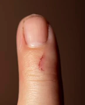 Finger scratch on a dark background Stock Photos