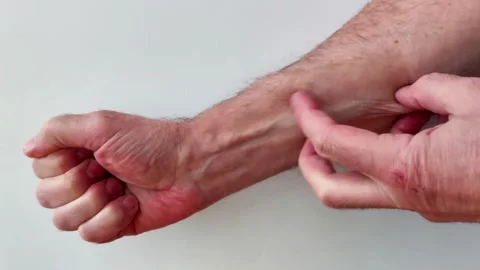 Finger Scratching Forearm to Show Skin Contact Action 動画素材 330761153