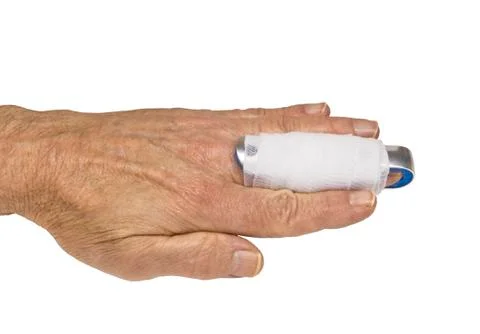Finger splint Stock Photos
