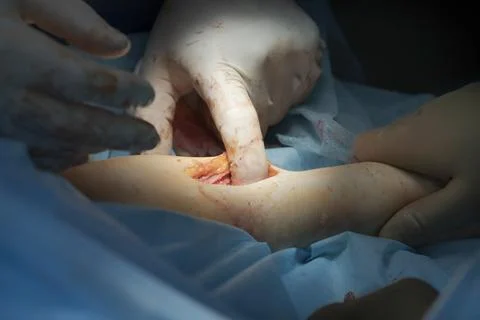 Finger In A Wound Photos