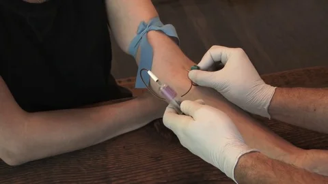 Finishing Up Taking Blood Sample Video stock 77976446
