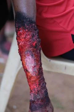 Fire burn makeup special effect Stock Photos