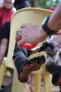 Fire burn makeup special effect Stock Photos