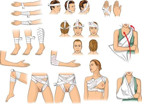 First aid bandaging techniques Illustrazione stock