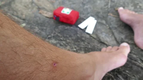 First aid on a hike in nature, a first aid kit Stock Footage 293189564
