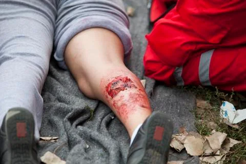 First aid Stock Photos