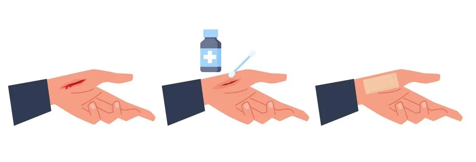 First aid for treating cut wound on hand. Treatment stages process for bleeding Stock Illustration
