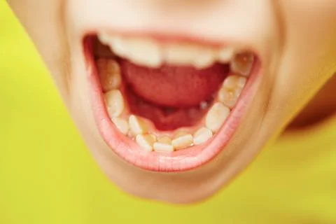 First and second teeth of the little boy Stock Photos