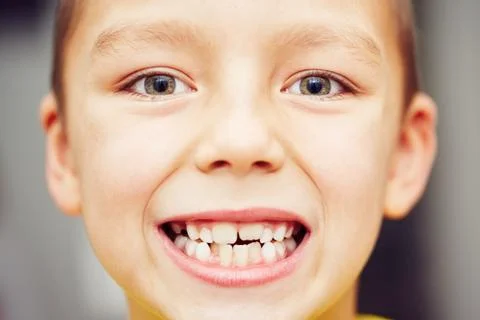 First and second teeth of the little boy Fotos Stock