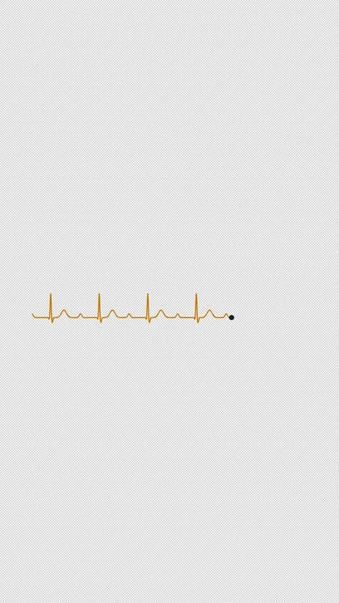 First Degree AV Block ECG Heart Rhythm Clean No Text 4K Vertical 9x16 Light 库存影片 339507218