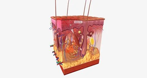A first degree burn is the most common, and one of the most common househol.. Stockillustratie