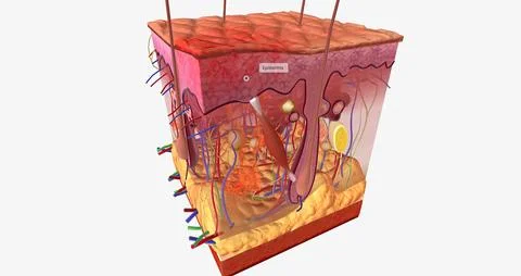 A first degree burn is the most common, and one of the most common househol.. Stockillustratie