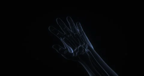 First dorsal interossei muscle of the hand in human body. X Ray. Loop Stock Footage 340066241