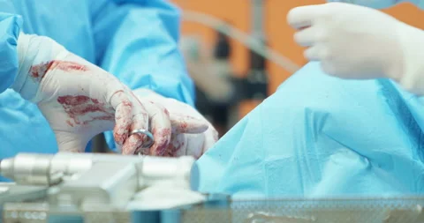 First plan blurred - focused surgery drill on sterilization containers with 库存影片 140163675