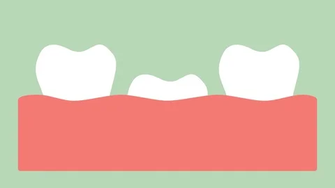First tooth or baby teeth Stock Footage 93328643