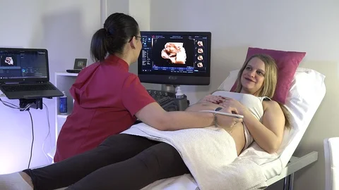 Firts time a mother watch her baby on ultrasound Stock Footage 88430786
