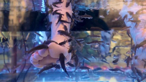 Fish-foot Stock Footage 101581579