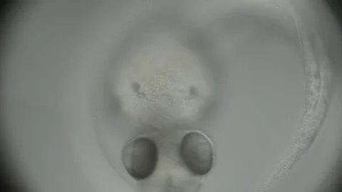 FishEmbryo2 Stock Footage 78577162